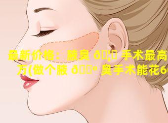 最新价格：腋臭 🦍 手术最高7万(做个腋 🌺 臭手术能花6000到7000)